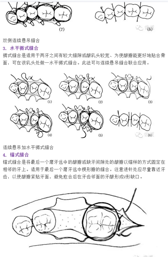牙醫(yī)基本技能：口內(nèi)縫合術(shù)（文字、示意圖及視頻）
