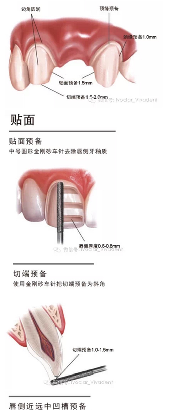 時(shí)常搞不清楚怎么備牙嗎？義獲嘉教您如何完美備牙
