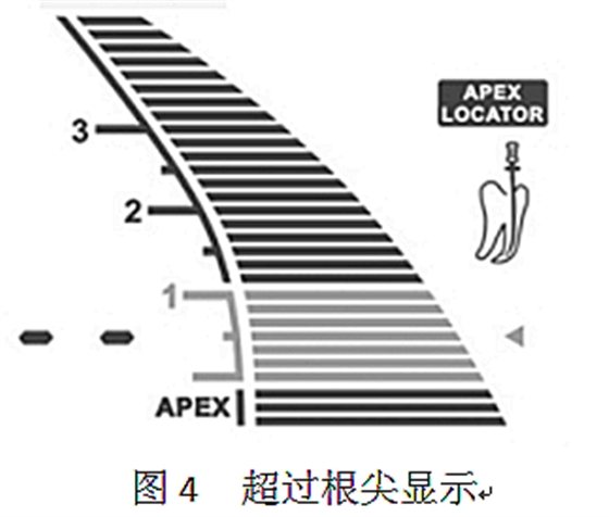 根管長(zhǎng)度測(cè)量?jī)x的使用