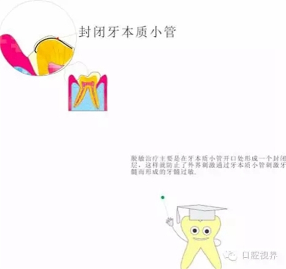  “什么是牙周袋沖洗？”