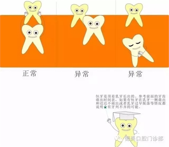 【愛牙科普知識300問】什么是牙垢和牙結(jié)石？