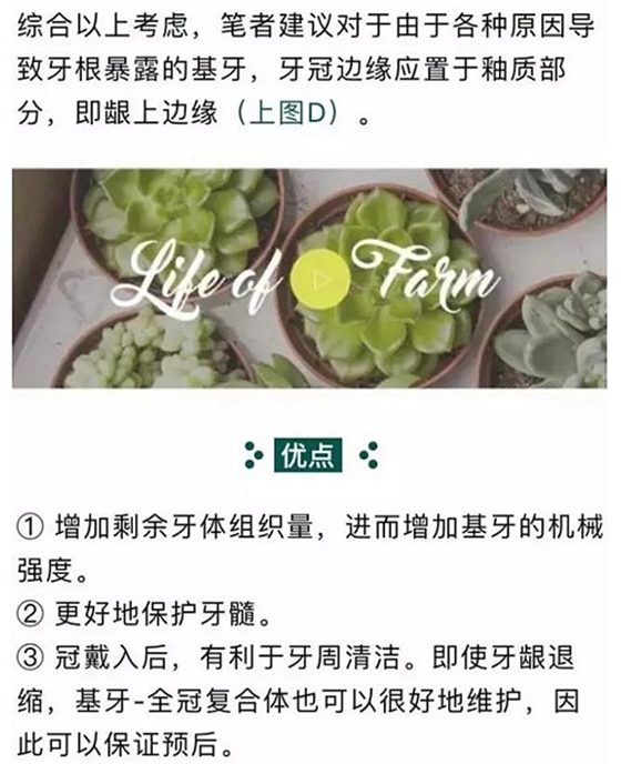 做全冠修復時基牙根面暴露，如何備牙？