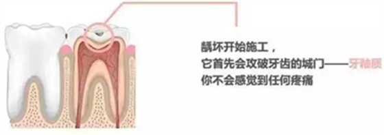 【收藏】關(guān)于補牙，知道這些就夠了！