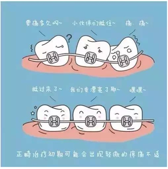 關(guān)于牙齒矯正，你想知道的都在這！