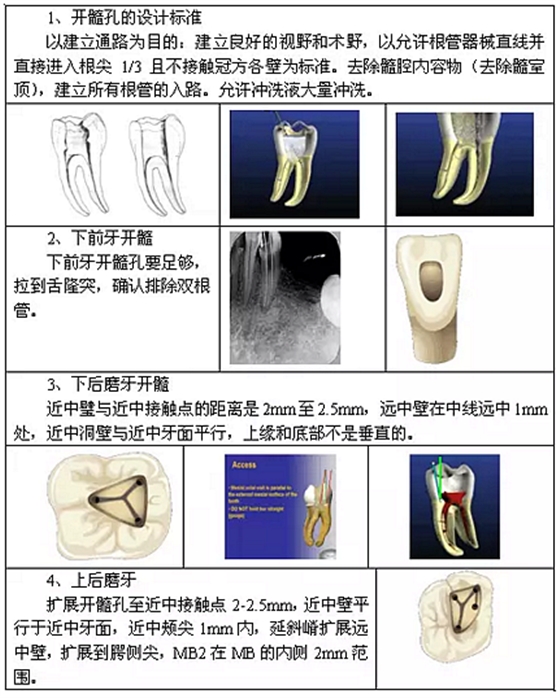 知識(shí)分享：根管治療的標(biāo)準(zhǔn)步驟