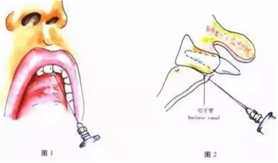 口腔醫(yī)生的十大危險(xiǎn)操作，你可能也中過(guò)標(biāo)！
