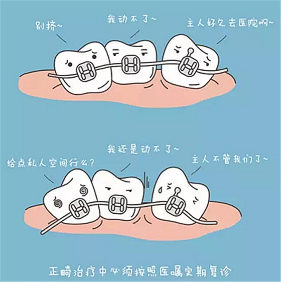 牙齒正畸過(guò)程中需注意哪些事項(xiàng)？
