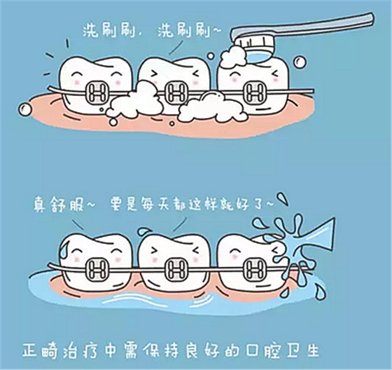 牙齒正畸過(guò)程中需注意哪些事項(xiàng)？