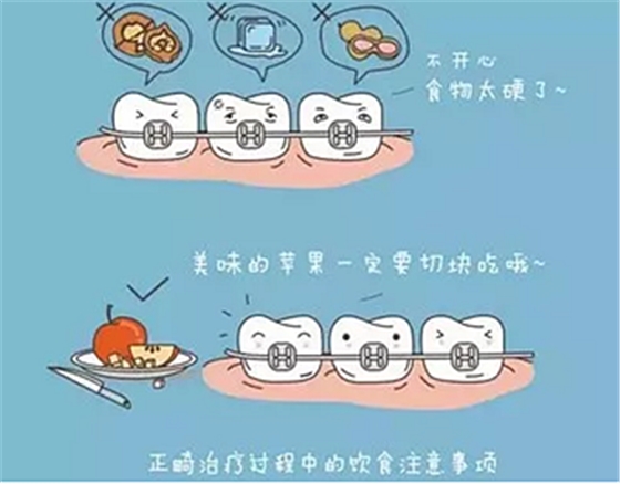 正畸需要注意些什么？