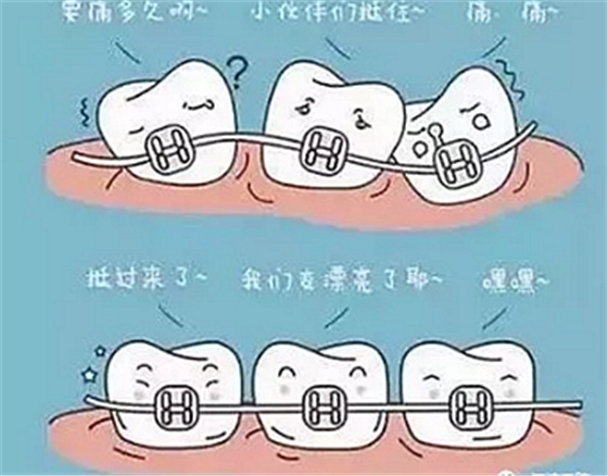正畸需要注意些什么？