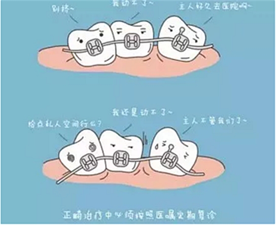正畸需要注意些什么？