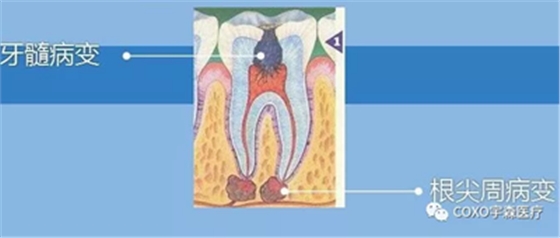 廠家來(lái)解說(shuō)：多頻技術(shù)的根管長(zhǎng)度測(cè)定儀