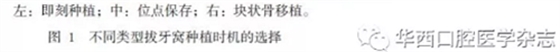 【專家共識】種植修復(fù)臨床評價標(biāo)準(zhǔn)