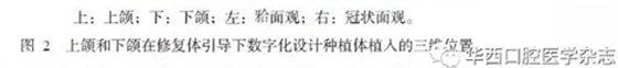 【專家共識】種植修復(fù)臨床評價標(biāo)準(zhǔn)