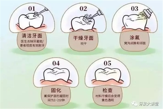 兒童防齲齒【窩溝封閉】和【涂氟】是一回事兒嗎？