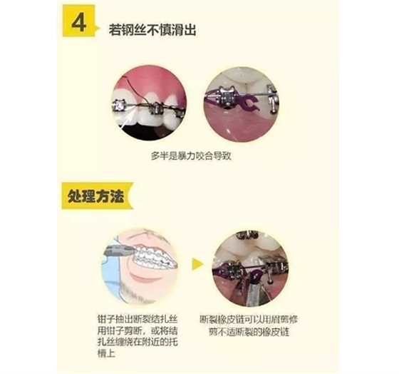 特殊時期為什么常規(guī)的口腔治療都不能做了？