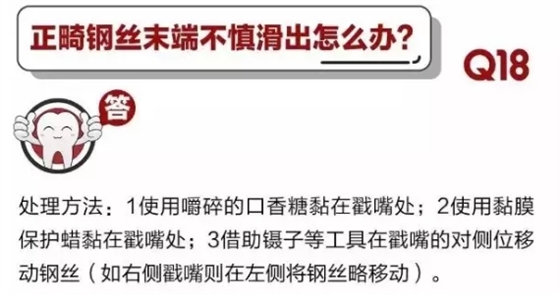 	 牙醫(yī)停診了？別怕，請您收下這份居家牙科急癥指南！