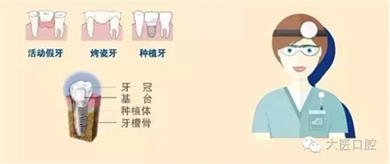 口腔科普?qǐng)D解