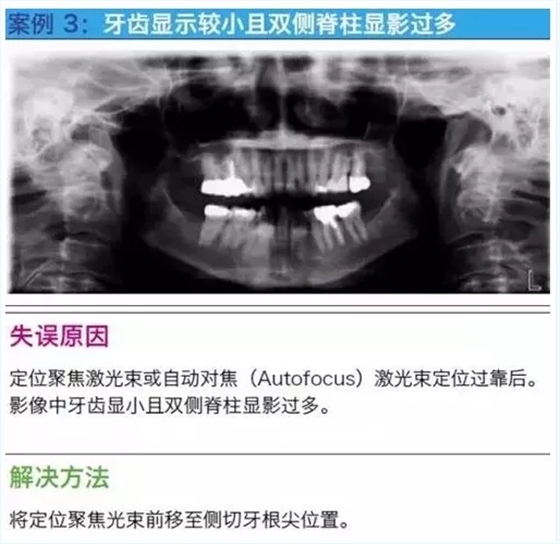 曲斷的10大經(jīng)典失誤案例及原因分析！
