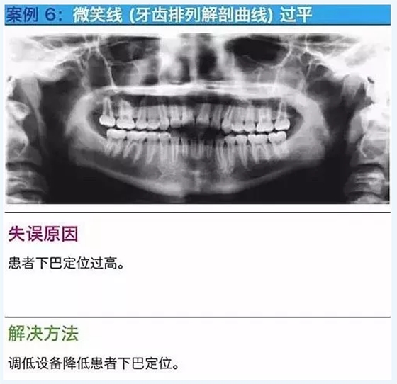 曲斷的10大經(jīng)典失誤案例及原因分析！