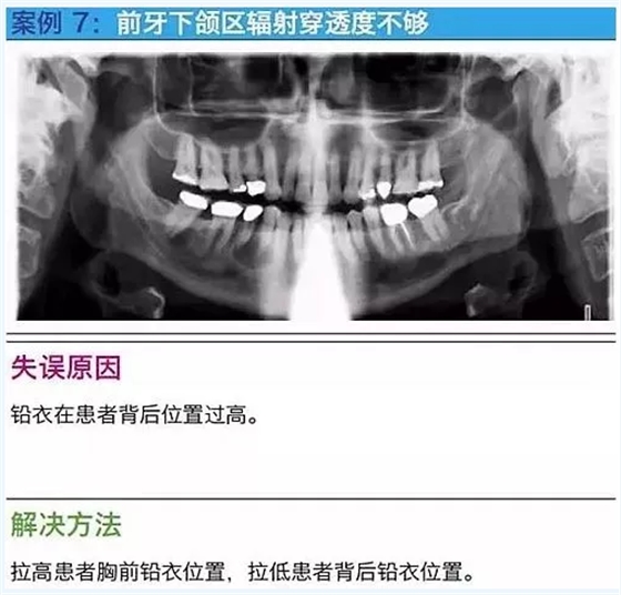 曲斷的10大經(jīng)典失誤案例及原因分析！