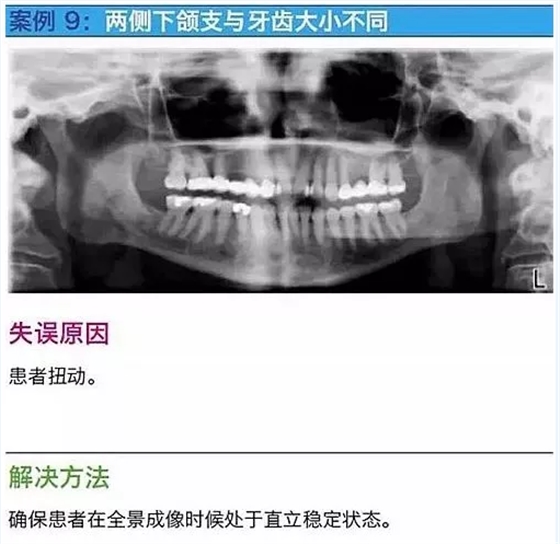 曲斷的10大經(jīng)典失誤案例及原因分析！