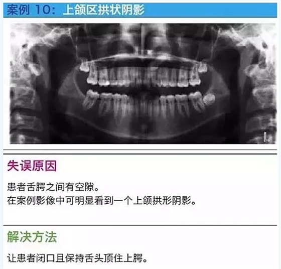 曲斷的10大經(jīng)典失誤案例及原因分析！