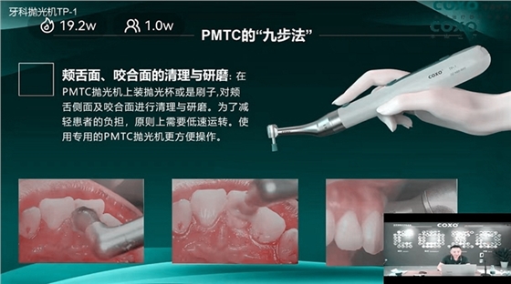 頰舌面、咬合面的清理與研磨