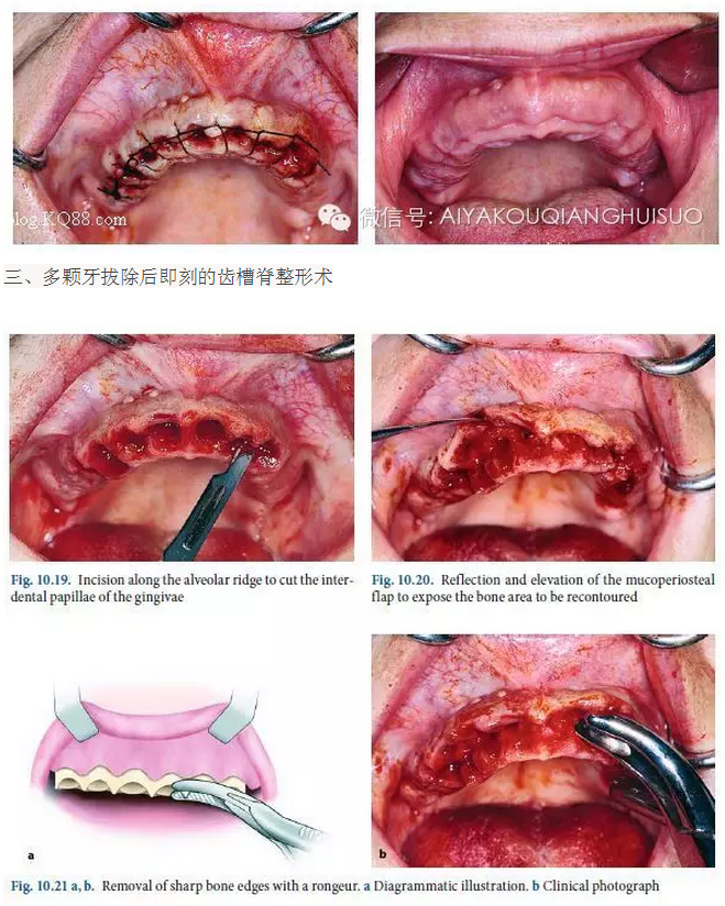 QQ圖片20150807105113.png QQ圖片20150807105113.png