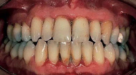 這十種常見口腔疾病，你有遇到過么？