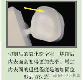 CR權威發(fā)布：如何克服氧化鋯粘固時的問題