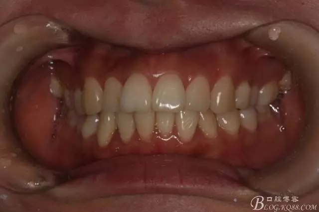 640.webp.jpg