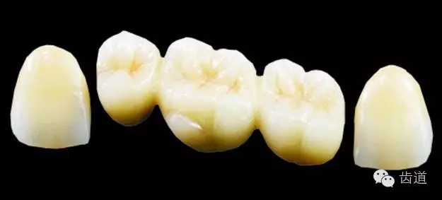 為何烤瓷牙的價(jià)格從幾百元至數(shù)千元不等？告訴您11種烤瓷牙的特點(diǎn)、價(jià)格及優(yōu)缺點(diǎn)