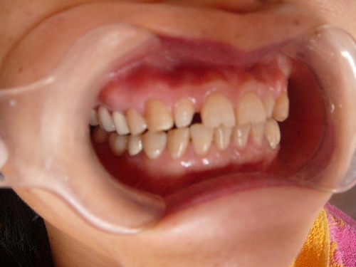 15876496_6.jpg 15876496_6.jpg