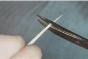 纖維樁臨床操作步驟