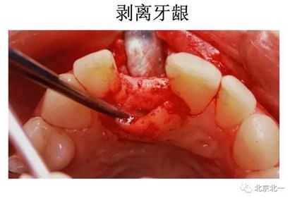 360截圖20170422174630675.jpg