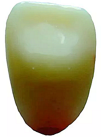 舌側無釉質層.png