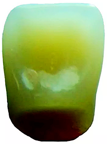 舌側釉質層.png