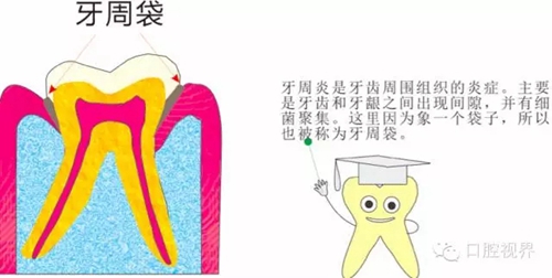 【愛牙科普知識300問】 “什么是牙本質(zhì)敏感？”