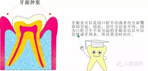 【愛牙科普知識300問】 “什么是牙本質(zhì)敏感？”
