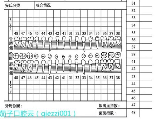 	口腔修復(fù)治療中，常見(jiàn)臨床接診流程