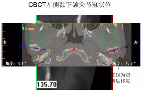 	口腔修復(fù)治療中，常見(jiàn)臨床接診流程