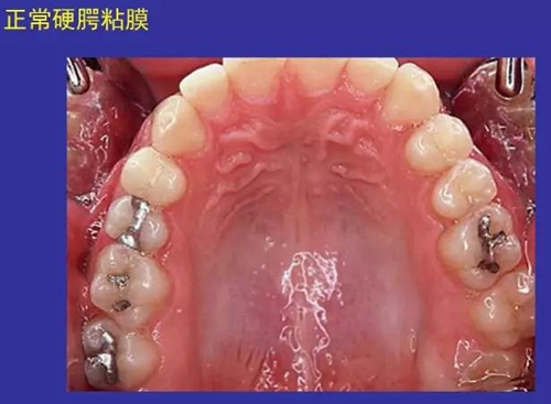 正?？谇火つぜ俺Ｒ姴p圖