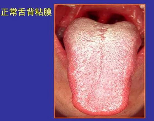 正?？谇火つぜ俺Ｒ姴p圖