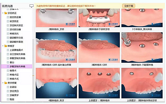 牙科普通前臺和優(yōu)秀前臺到底差在哪？