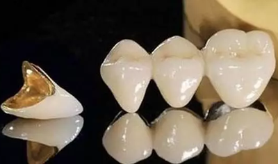 補牙不做冠，療效少一半！根管治療后牙齒已經(jīng)不疼了，為什么還要戴牙冠呢？