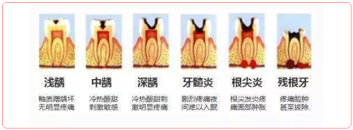 特殊時(shí)期為什么常規(guī)的口腔治療都不能做了？