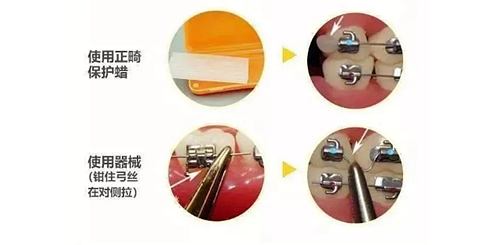 特殊時(shí)期為什么常規(guī)的口腔治療都不能做了？