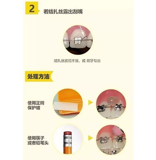 特殊時(shí)期為什么常規(guī)的口腔治療都不能做了？