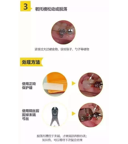 特殊時(shí)期為什么常規(guī)的口腔治療都不能做了？